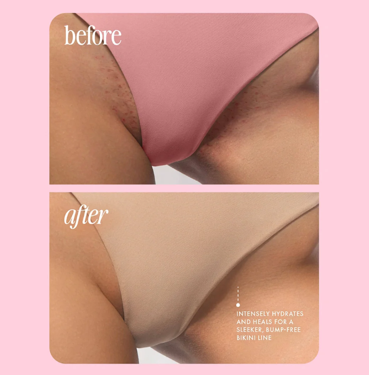 Goatix Bikini Trimmer